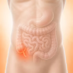 Pain in the Lower Right Abdomen: Causes and Signs of Appendicitis